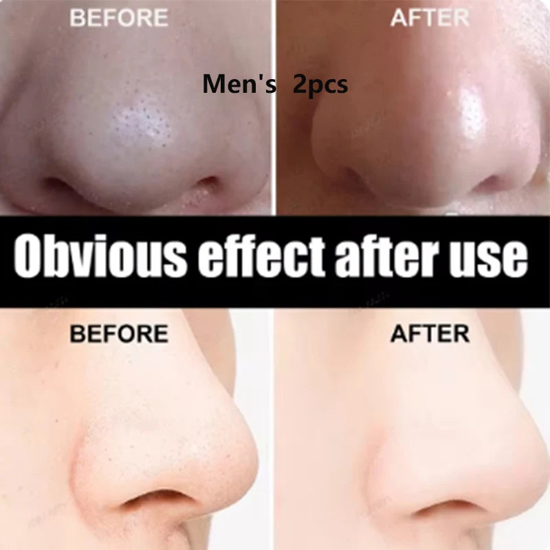 Bamboo Charcoal Clean Nose Patches Face Cleansing Quickly Remove Blackheads Comedones Shrink Pore Skin Care Mask Patch Anti Acne
